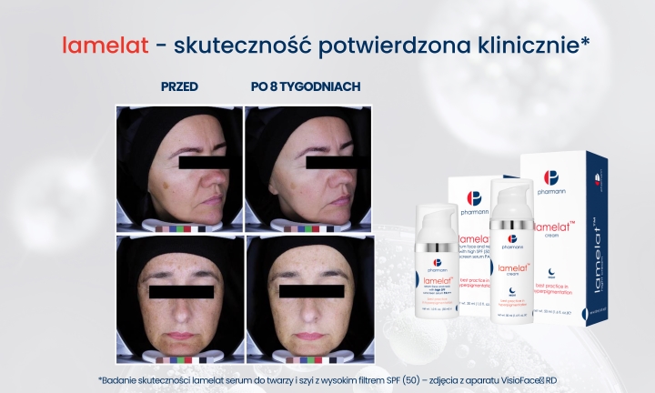 lamelat w badaniach klinicznych lamelat w badaniach klinicznych