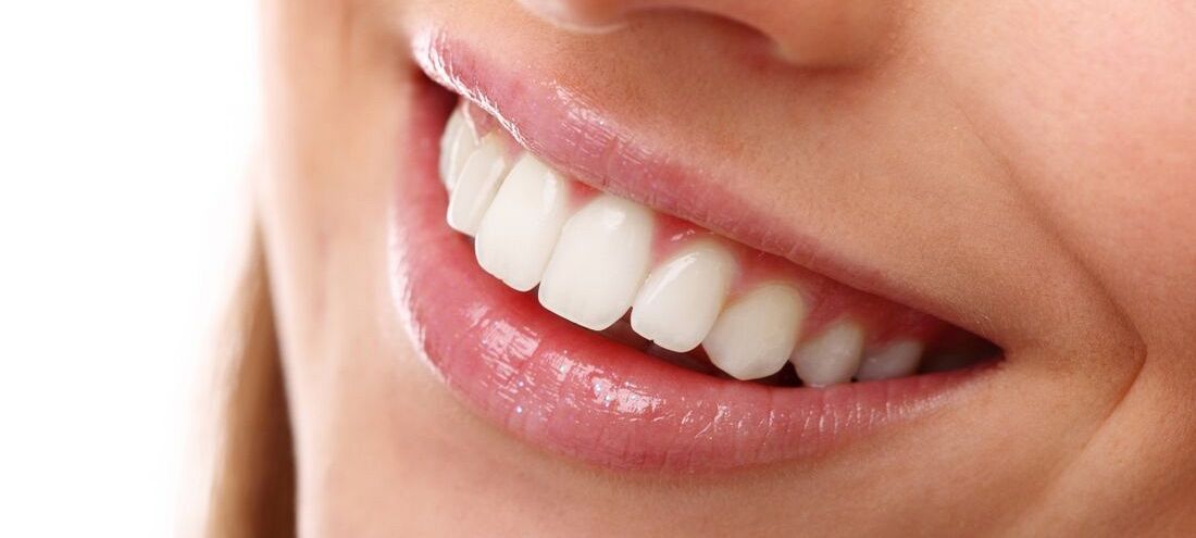 Wybielanie zębów z Tik Toka – moda, która może zaszkodzić. Stomatolog wyjaśnia, dlaczego warto uważać