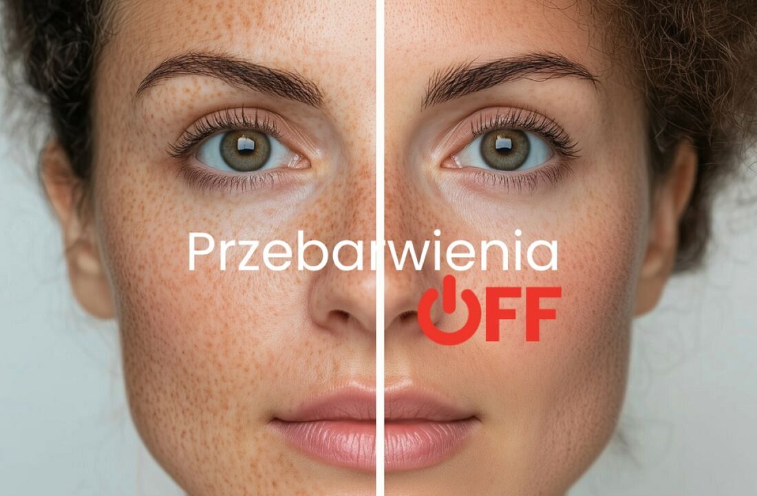 Pielęgnacja skóry z przebarwieniami latem: skuteczna strategia oparta na serii lamelat™ od Pharmann 