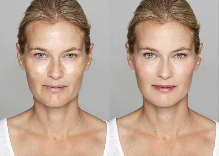 Zabiegi estetyczne na twarz po 40. roku życia 