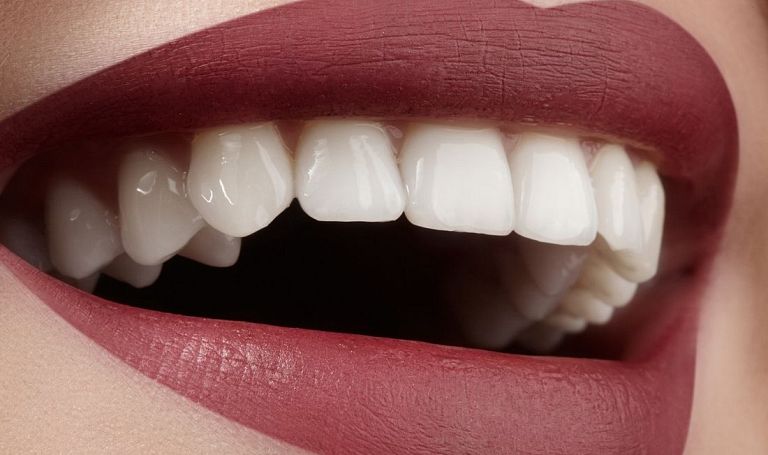 Czym jest bonding zębów?