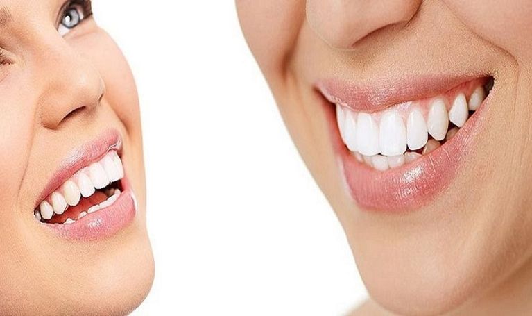 Jak chronić zęby przed osadami i przebarwieniami?