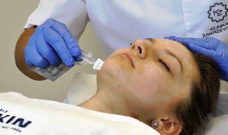 Peeling salicylowy Enerpeel w walce z trądzikiem zaskórnikowo-grudkowym