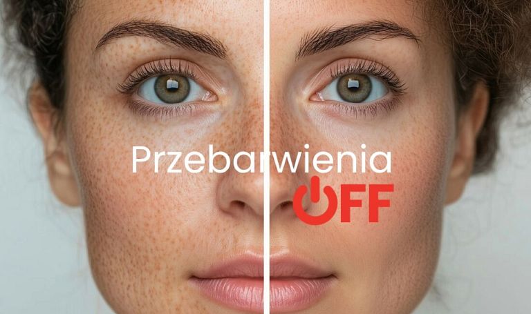 Pielęgnacja skóry z przebarwieniami latem: skuteczna strategia oparta na serii lamelat™ od Pharmann