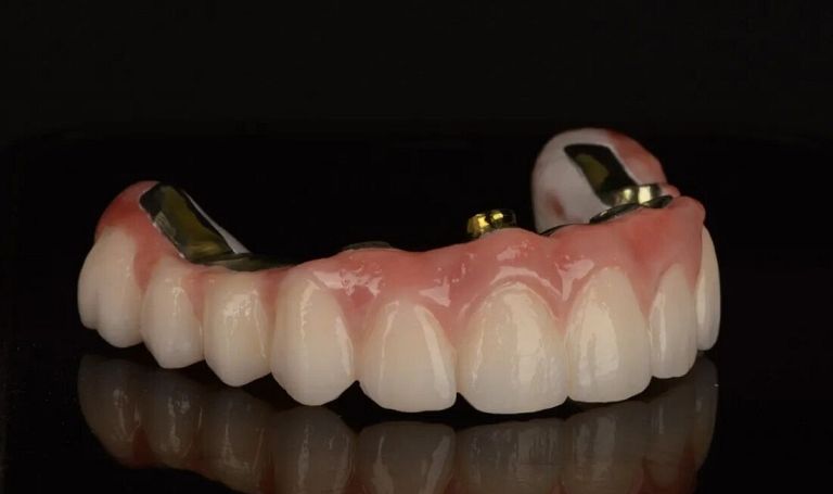 Metamorfoza uśmiechu krok po kroku