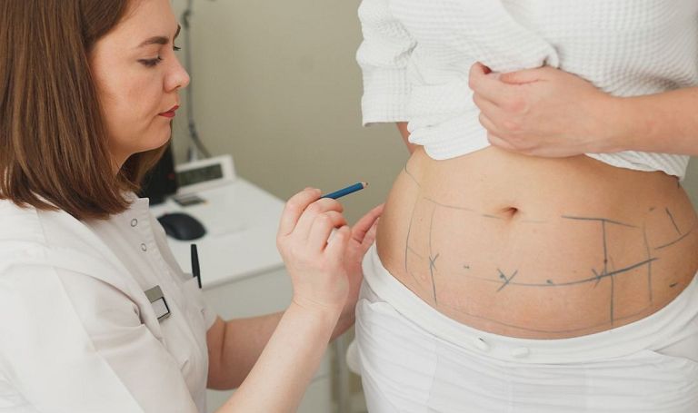 Abdominoplastyka odwrócona – ryzyko większe od korzyści?