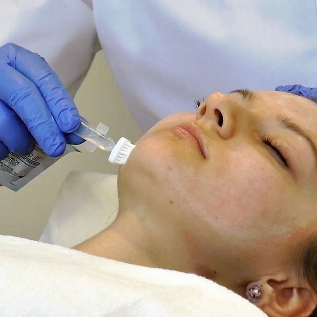 Peeling salicylowy Enerpeel w walce z trądzikiem zaskórnikowo-grudkowym