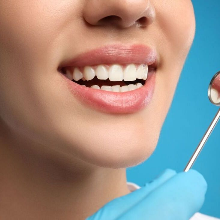 De-aging zębów, czyli jak odmłodzić uśmiech?