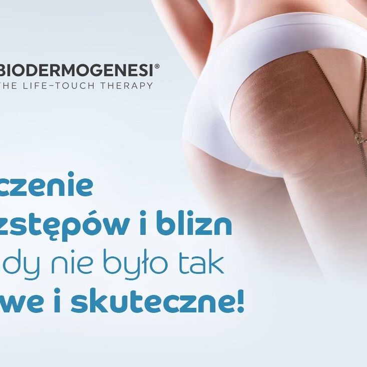 Biodermogenesi® rewolucyjna terapia do leczenia rozstępów, blizn oraz regeneracji skóry