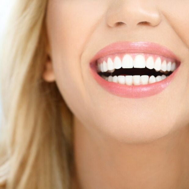 Poprawa estetyki zębów okiem ortodonty