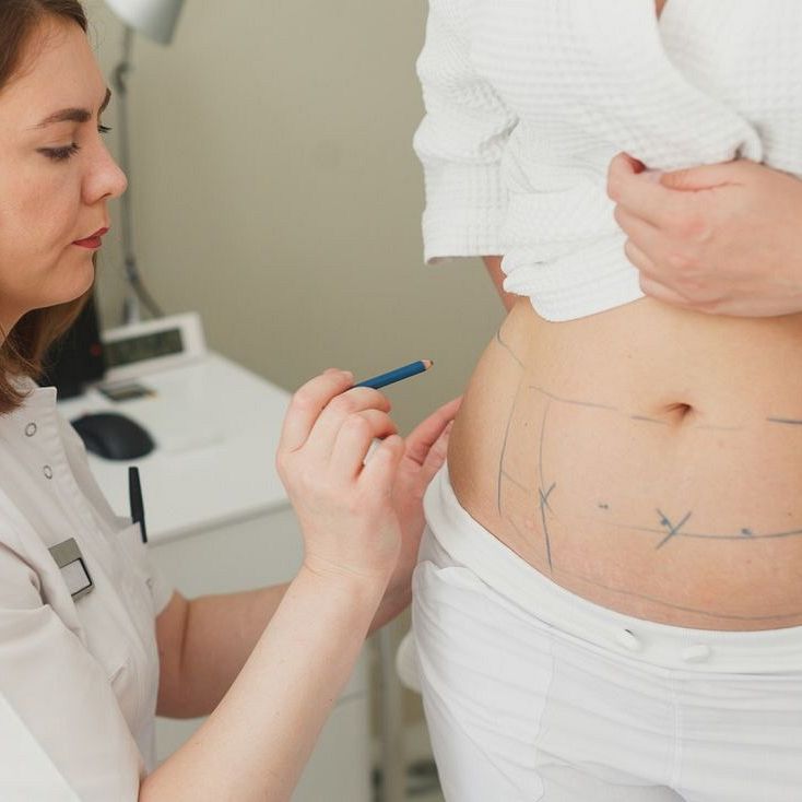 Abdominoplastyka odwrócona – ryzyko większe od korzyści?